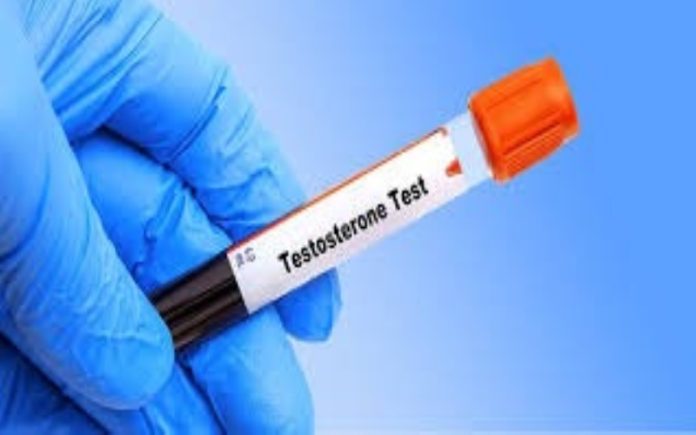Testosterone Testing Made Easy: What Every Man Needs to Know