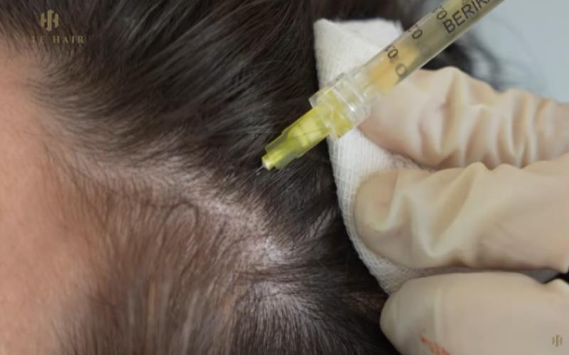 Stem Cell Hair