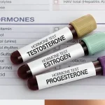 Hormone Therapy
