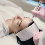 Microneedling